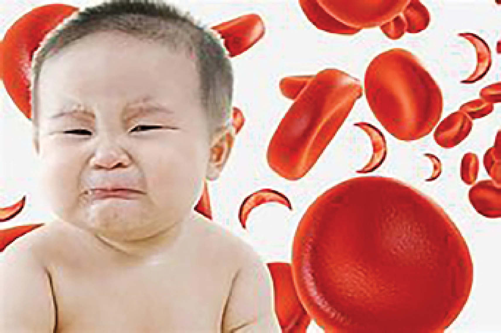 آفتاب یزد در گفتگو با متخصصان بررسی کرد علائم کم خونی در کودکان و راه‌های درمان آن