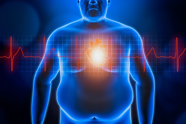 چاقی باعث کدام بیماری‌های قلبی می‌شود؟